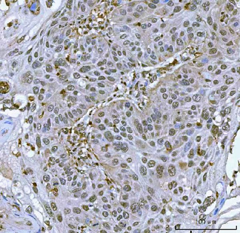 Anti-SART3 Antibody