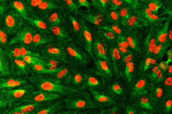 Anti-SART1 Antibody