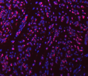 Anti-SART1 Antibody