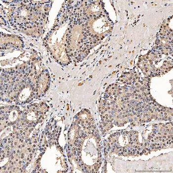 Anti-SART1 Antibody