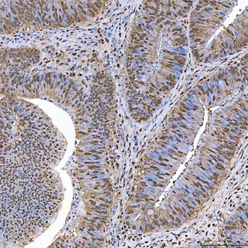 Anti-SART1 Antibody