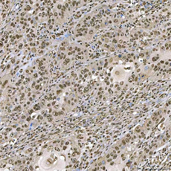 Anti-SART1 Antibody