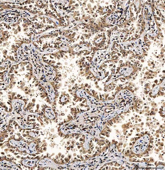 Anti-SART1 Antibody