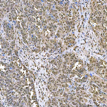 Anti-SART1 Antibody