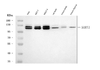 Anti-SART1 Antibody
