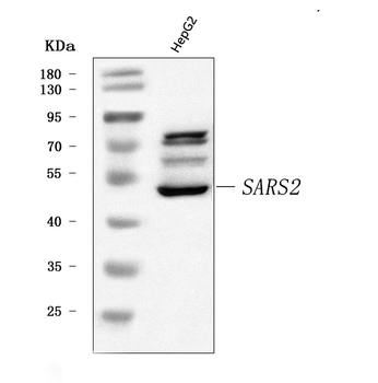 Anti-SARS2 Antibody