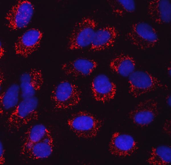 Anti-SARS2 Antibody