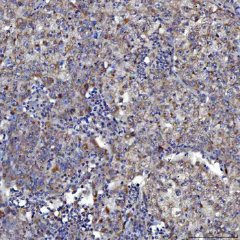 Anti-SARS2 Antibody