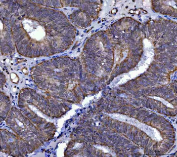 Anti-SARS2 Antibody