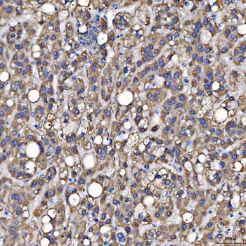 Anti-SARS2 Antibody