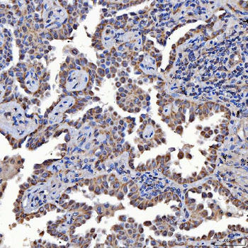 Anti-SARS2 Antibody