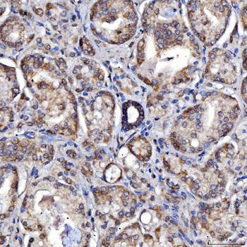 Anti-SARS2 Antibody