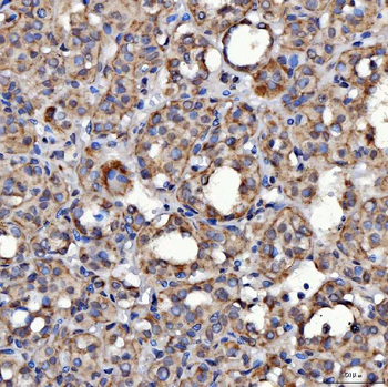 Anti-SARS2 Antibody