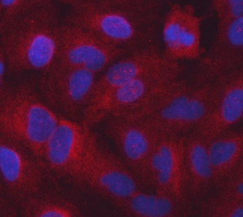 Anti-Seryl-tRNA synthetase/SERS/SARS1 Antibody