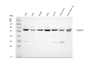 Seryl-tRNA synthetase/SERS/SARS1 Antibody
