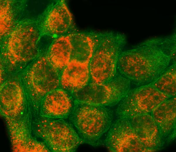 Anti-SAP18 Antibody