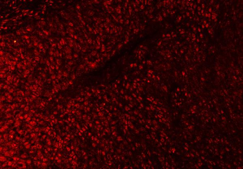 Anti-SAP18 Antibody