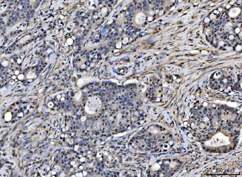 Anti-SAP18 Antibody