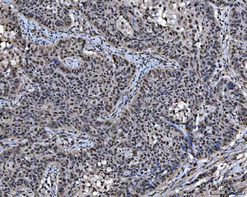 Anti-SAP18 Antibody