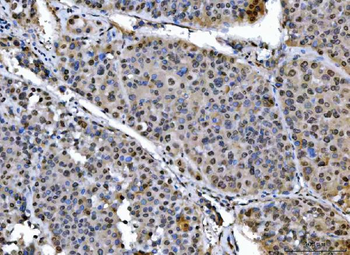 Anti-SAP18 Antibody