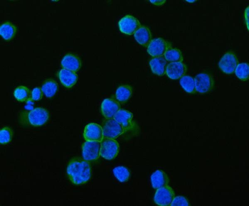 Anti-SAMSN1 Antibody
