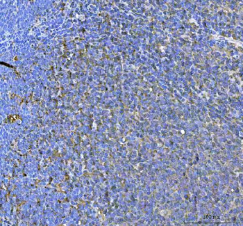 Anti-SAMSN1 Antibody