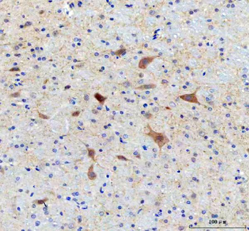 Anti-SAMSN1 Antibody