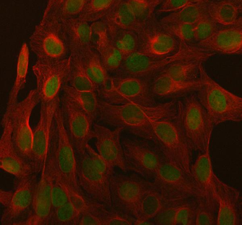 Anti-SAGE1 Antibody