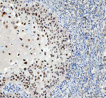 Anti-SAGE1 Antibody