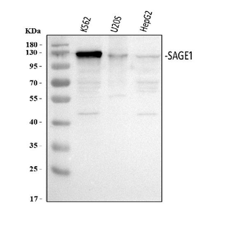 Anti-SAGE1 Antibody