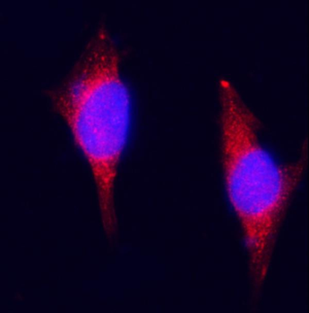 Anti-ZAC/Plagl1 Antibody
