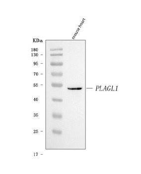 ZAC/Plagl1 Antibody