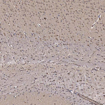 Anti-NOB1 Antibody