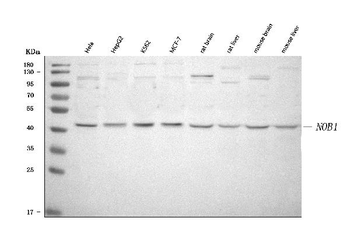 Anti-NOB1 Antibody