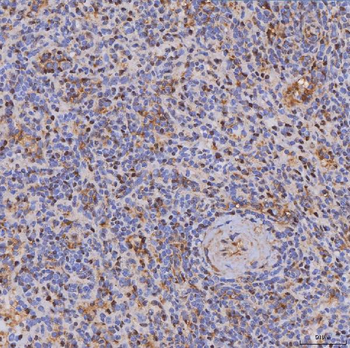 Anti-ITK Antibody