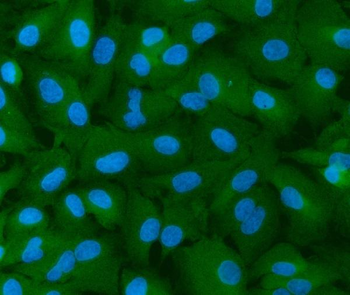 Anti-INF2 Antibody