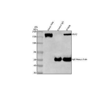 Anti-INF2 Antibody