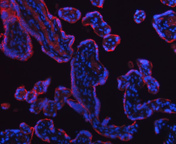 Anti-HSD11B2 Antibody