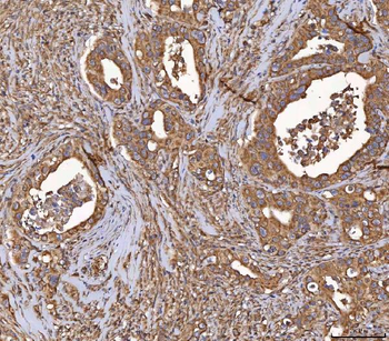 Anti-HSD11B2 Antibody