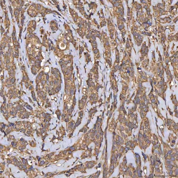 Anti-HSD11B2 Antibody
