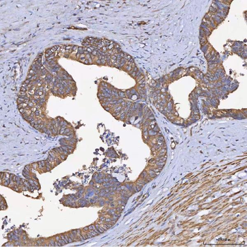 Anti-HSD11B2 Antibody