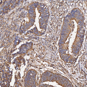 Anti-HSD11B2 Antibody