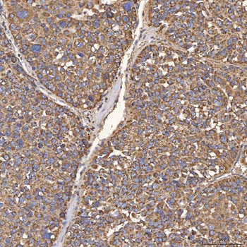 Anti-HSD11B2 Antibody
