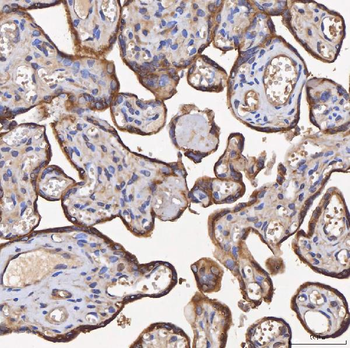 Anti-HSD11B2 Antibody