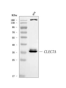 Anti-Dectin-1/CLEC7A Antibody