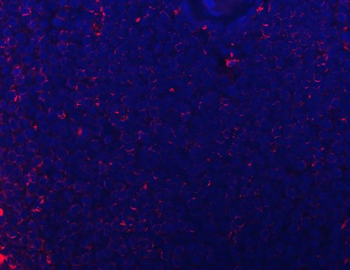 Anti-CD74 Antibody