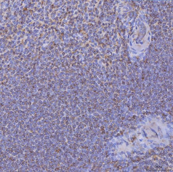 Anti-CD74 Antibody