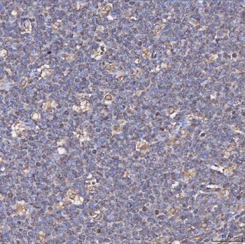 Anti-CD74 Antibody