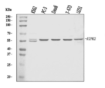 Anti-RIP2/RIPK2 Antibody