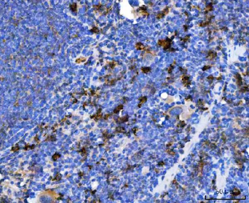 Anti-TXNDC5 Antibody